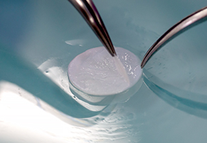 Reconstructed Human Epidermis