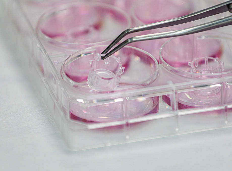 Insert of SkinEthic HCE model