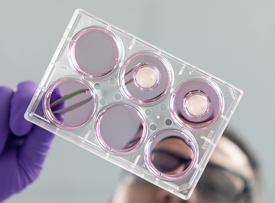 SkinEthic Human Oral Epithelium HOE