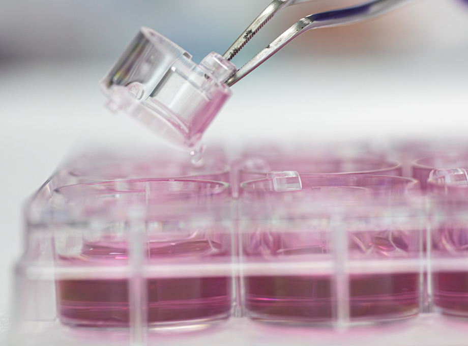 SkinEthic Human Vaginal Epithelium HVE