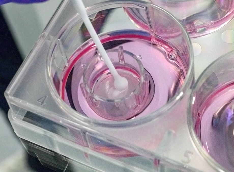 Oral and Gingival Irritation