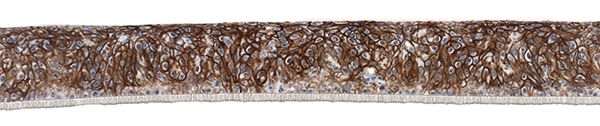SkinEthic HBE CD44