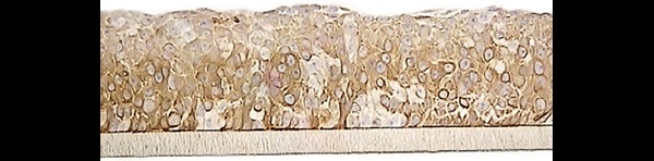 SkinEthic HO2E Keratin 13