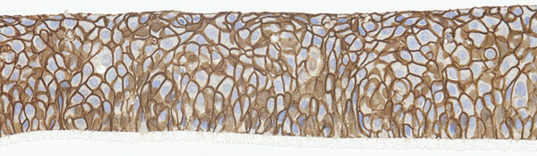 SkinEthic HOE CD44