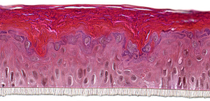 RHE-LC in vitro