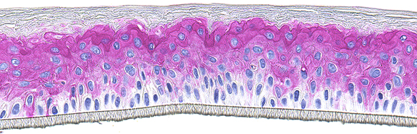 SkinEthic RHE Involucrin