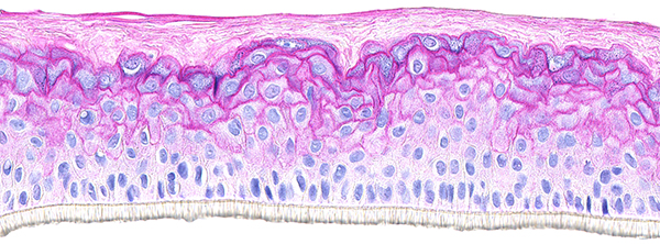 SkinEthic RHE Transglutaminase