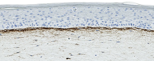 T-Skin Collagen IV
