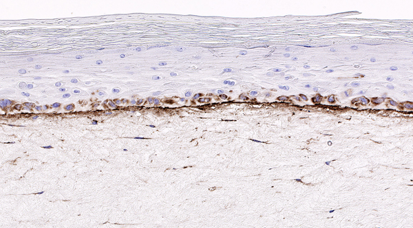 Laminin V