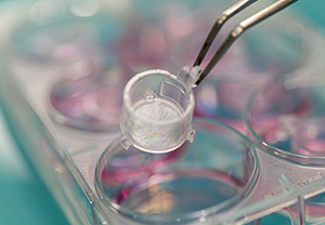 SkinEthic Reconstructed Human Epidermis